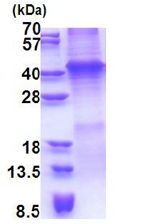 SDS-PAGE - Recombinant Human Wnt7a protein (denatured) (AB171487), expandable thumbnail
