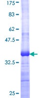 Recombinant Human Wnt7b protein