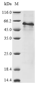 SDS-PAGE - Recombinant Human Wnt7b protein (AB289780)