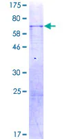 SDS-PAGE - Recombinant Human Wnt9a protein (GST tag N-Terminus) (AB159814)
