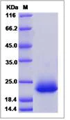 SDS-PAGE - Recombinant Human Xg blood group protein (His tag) (AB276663)