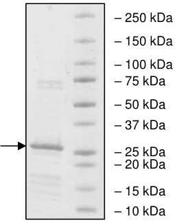 SDS-PAGE - Recombinant human XIAP protein (His tag N-Terminus) (AB198451)