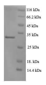 SDS-PAGE - Recombinant Human XPC protein (His tag) (AB236173)