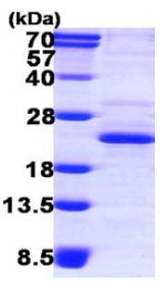 SDS-PAGE - Recombinant Human XTP3TPA protein (AB119438), expandable thumbnail