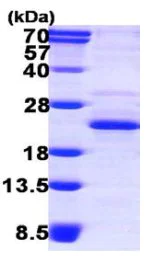 SDS-PAGE - Recombinant Human XTP3TPA protein (His tag N-Terminus) (AB119438)