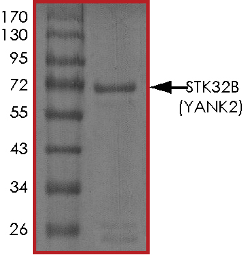 Recombinant human YANK2 protein