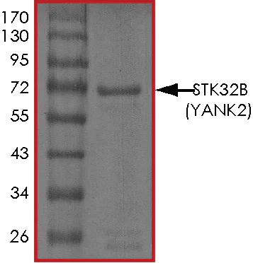 SDS-PAGE - Recombinant human YANK2 protein (AB125574)