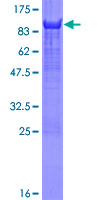Recombinant Human YAP1 protein