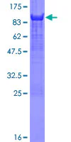 SDS-PAGE - Recombinant Human YAP1 protein (GST tag N-Terminus) (AB132459)
