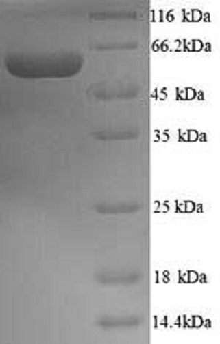 SDS-PAGE - Recombinant Human YAP1 protein (His tag) (AB241236), expandable thumbnail