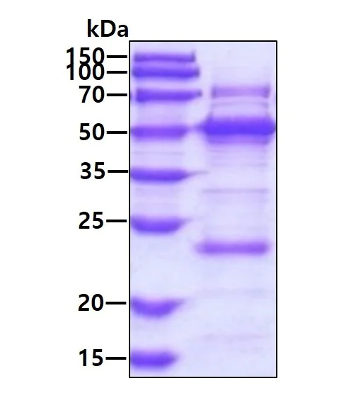 SDS-PAGE - Recombinant Human YARS2/TyRS protein (His tag N-Terminus) (AB126680)