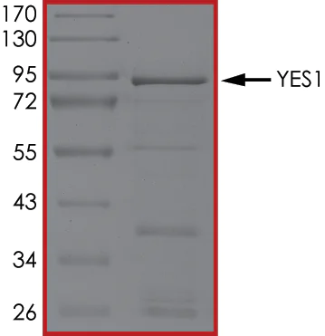 SDS-PAGE - Recombinant human Yes1 protein (Active) (AB101504)