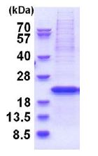 SDS-PAGE - Recombinant Human YIF1B protein (denatured) (His tag N-Terminus) (AB180309)