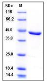 SDS-PAGE - Recombinant Human YKL-39 protein (His tag) (AB276466)