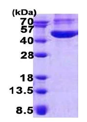 SDS-PAGE - Recombinant Human YKL-40/CHI3L1 protein (AB140057)