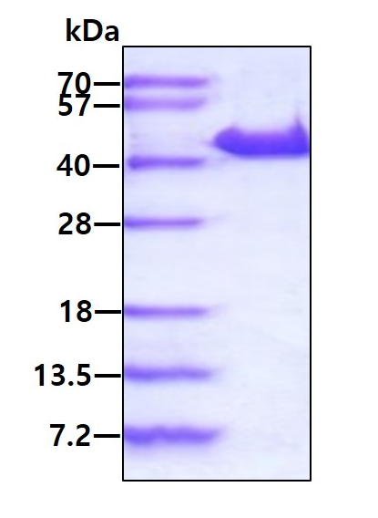 SDS-PAGE - Recombinant Human YOD1 protein (His tag N-Terminus) (AB140732)