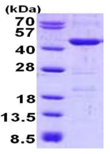 SDS-PAGE - Recombinant Human YOD1 protein (His tag N-Terminus) (AB140732)