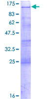 SDS-PAGE - Recombinant Human YTHDC1 protein (AB164876)