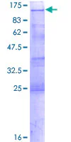 SDS-PAGE - Recombinant Human YTHDC1 protein (GST tag N-Terminus) (AB164876)