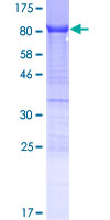 SDS-PAGE - Recombinant Human YTHDF3 protein (GST tag N-Terminus) (AB166020)