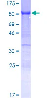SDS-PAGE - Recombinant Human YTHDF3 protein (GST tag N-Terminus) (AB166020)