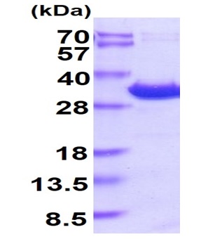 SDS-PAGE - Recombinant Human YWHAE protein (His tag) (AB219215), expandable thumbnail