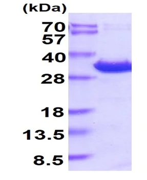 SDS-PAGE - Recombinant Human YWHAE protein (His tag) (AB219215)