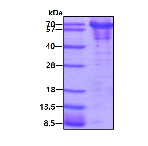 SDS-PAGE - Recombinant Human YY1 protein (His tag) (AB187479)