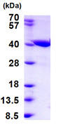 SDS-PAGE - Recombinant Human ZADH2 protein (AB187469), expandable thumbnail