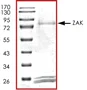 SDS-PAGE - Recombinant human ZAK protein (AB89852)