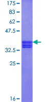 SDS-PAGE - Recombinant Human ZAN protein (GST tag N-Terminus) (AB159808)