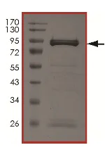 SDS-PAGE - Recombinant human ZAP70 (mutated Y319F) protein (AB204139)