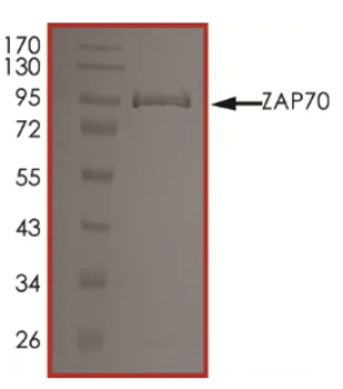 SDS-PAGE - Recombinant human ZAP70 protein (AB60963)