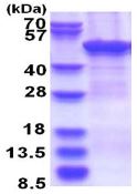 SDS-PAGE - Recombinant Human ZCCHC12 protein (denatured) (His tag N-Terminus) (AB181905)