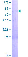 SDS-PAGE - Recombinant Human ZCCHC3 protein (AB164746), expandable thumbnail