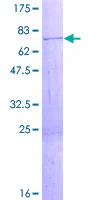 SDS-PAGE - Recombinant Human ZCCHC3 protein (AB164746)
