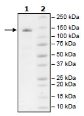 Recombinant human ZCH11 protein (Tagged)