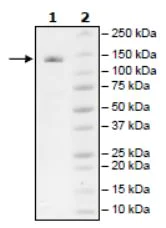 SDS-PAGE - Recombinant human ZCH11 protein (Tagged) (AB271776)