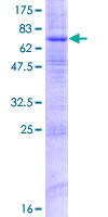 SDS-PAGE - Recombinant Human ZDHHC9 protein (AB162420), expandable thumbnail