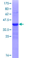 SDS-PAGE - Recombinant Human ZEB1 protein (AB152728), expandable thumbnail