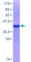 SDS-PAGE - Recombinant Human ZEB1 protein (GST tag N-Terminus) (AB152728)