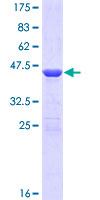 SDS-PAGE - Recombinant Human ZFHX4 protein (AB164108), expandable thumbnail