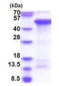 SDS-PAGE - Recombinant Human Zhangfei protein (His tag N-Terminus) (AB183253)