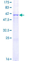 Recombinant Human Zinc Alpha 2 Glycoprotein