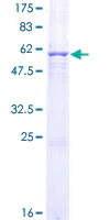 SDS-PAGE - Recombinant Human Zinc Alpha 2 Glycoprotein (GST tag N-Terminus) (AB152222)