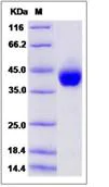 SDS-PAGE - Recombinant Human Zinc Alpha 2 Glycoprotein (His tag) (AB276519)