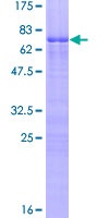SDS-PAGE - Recombinant Human Zinc finger protein 276 (AB164919)