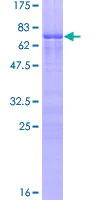 SDS-PAGE - Recombinant Human Zinc finger protein 276 (AB164919)