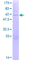 SDS-PAGE - Recombinant Human Zinc finger protein 691 (GST tag N-Terminus) (AB162402)
