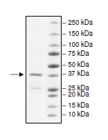 SDS-PAGE - Recombinant Human ZMYND8 protein (GST tag N-Terminus) (AB195163)